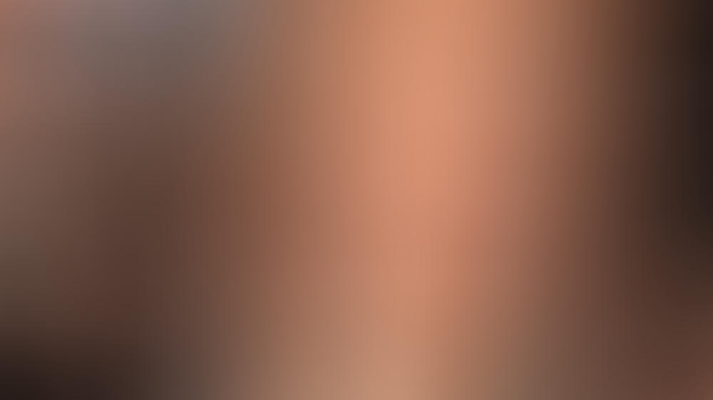 Bella Hadid: "Ich will mein Gesicht nicht verunstalten" Bella Hadid: "Ich will mein Gesicht nicht verunstalten"