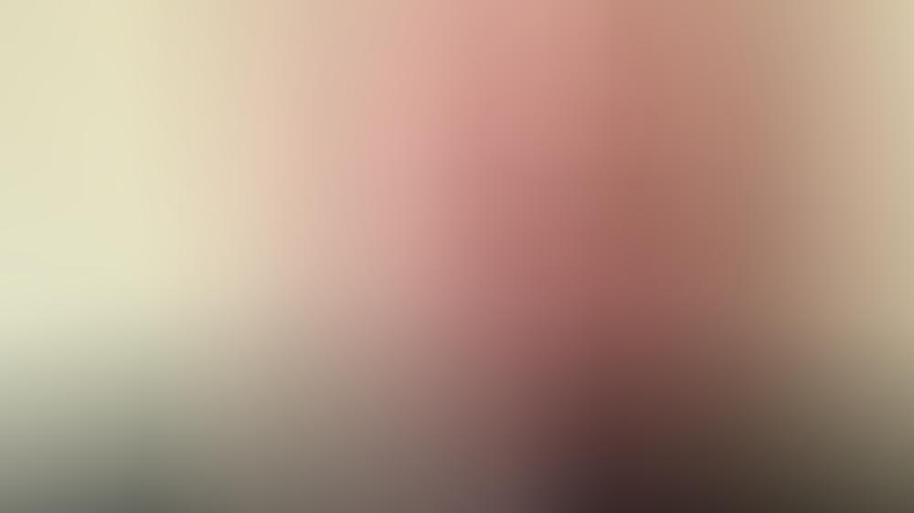 Harald Glööckler postet schockierendes Selfie aus dem Krankenhaus Allergie-Schock! So geht es Harald Glööckler jetzt