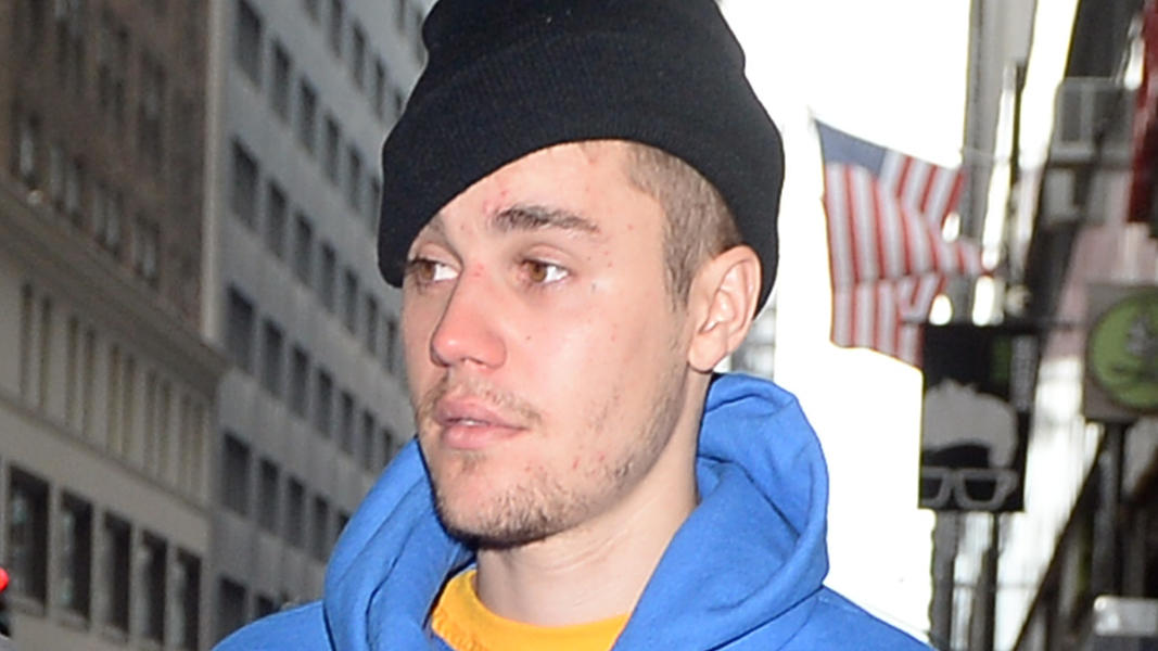 Sorge um Justin Bieber: Das sagt Mutter Pattie Mallette zu seinem Zustand Justin Bieber photographed leaving a therapist building after news came out thay Bieber is going counseling for depressionPictured: Justin BieberRef: SPL5064660 150219 NON-EXCLUSIVEPicture by: Elder Ordonez / SplashNews.comSplash News and PicturesL