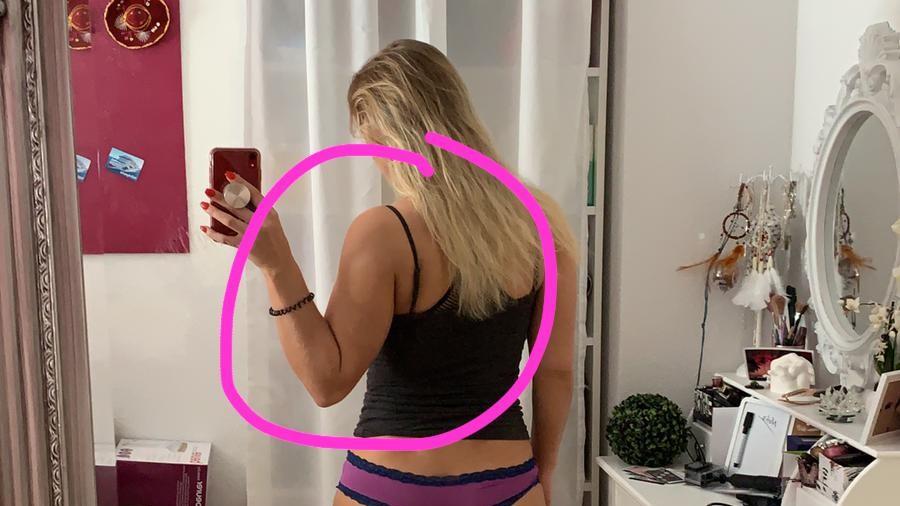 Saskia Atzerodt plant weiteren Beauty-Eingriff Saskia Atzerodt zeigt ihre Arme