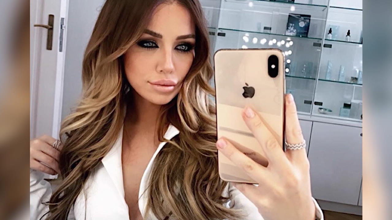 Kim Gloss muss mit starken Schmerzen ins Krankenhaus: „Es ging nicht mehr“ Kim Gloss
