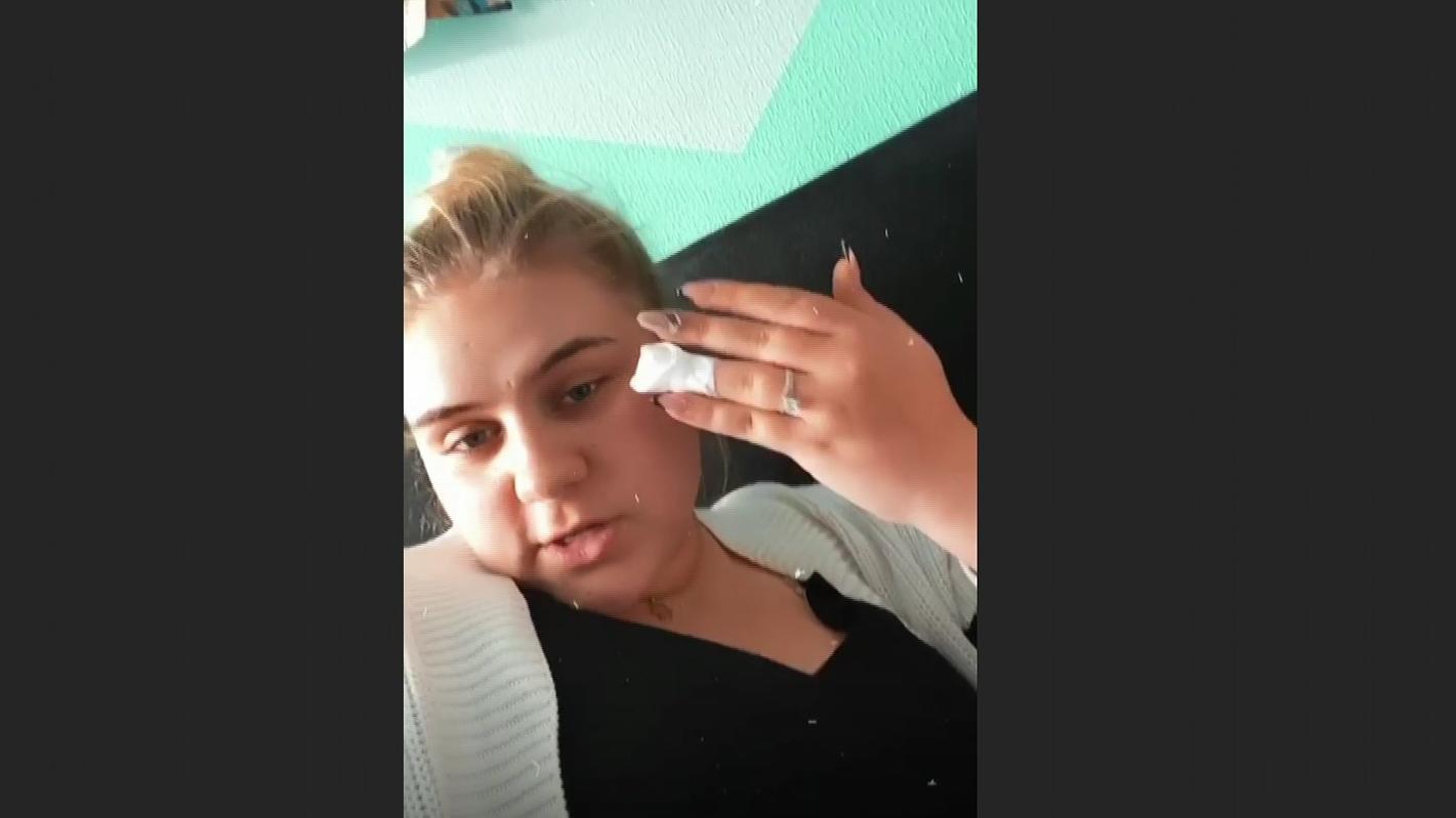 Estefania Wollny reiÃŸt sich den halben Fingernagel raus - â€žDas tut so extrem weh!â€œ - VIP.de, Star News