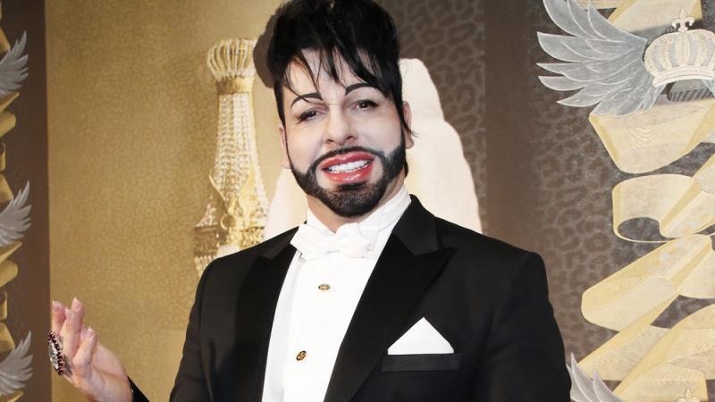 Harald Glööckler: Endlich wieder Botox! Harald Glööckler: Endlich wieder Botox!