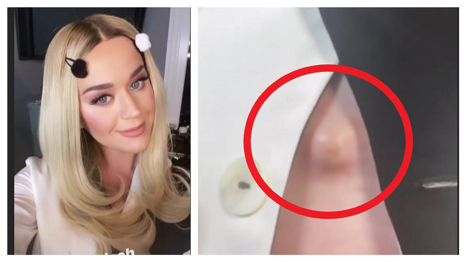 Katy Perrys Bauchnabel wölbt sich „ekelhaft“ nach außen Was ist denn mit Katy Perrys Bauchnabel los?!