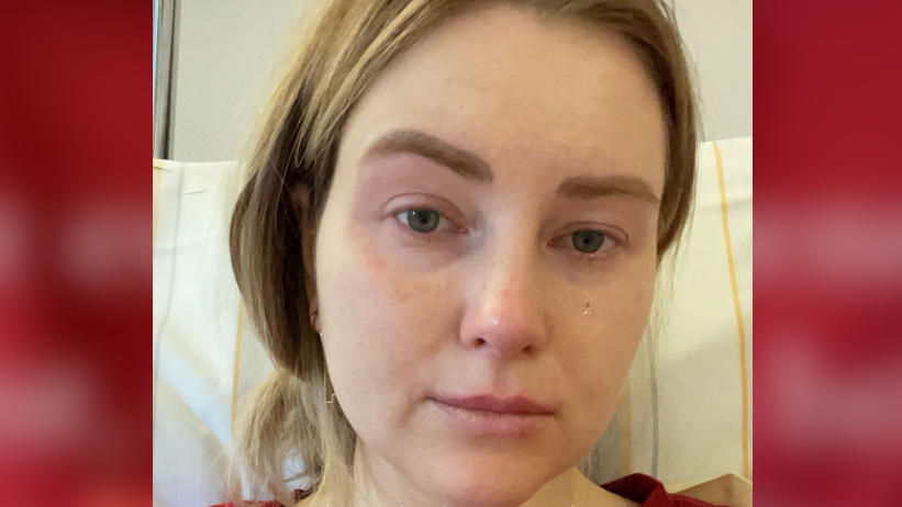 Maren Wolf verliert fast eine Niere - Not-OP rettet den YouTube-Star Maren Wolfs Insta-Story aus der Klinik