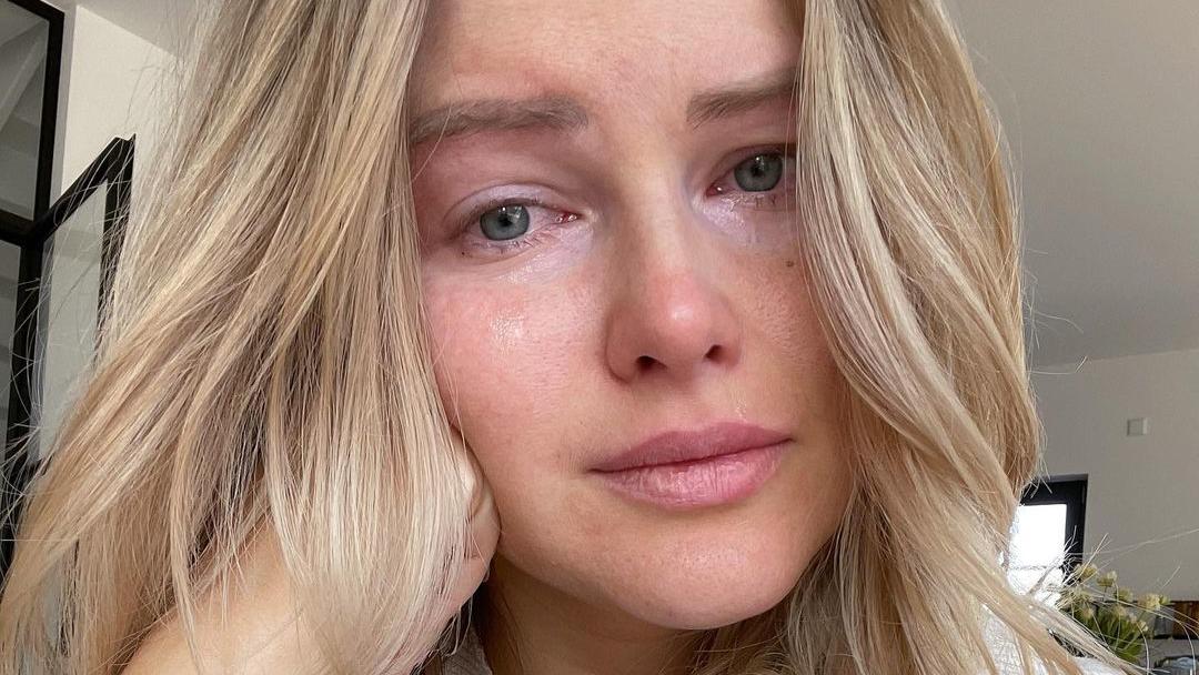 Maren Wolf muss zur Blasenspiegelung: Neuer gesundheitlicher Rückschlag? Die YouTuberin Maren Wolf hat erst kürzlich eine schockierende Disgnose erhalten.