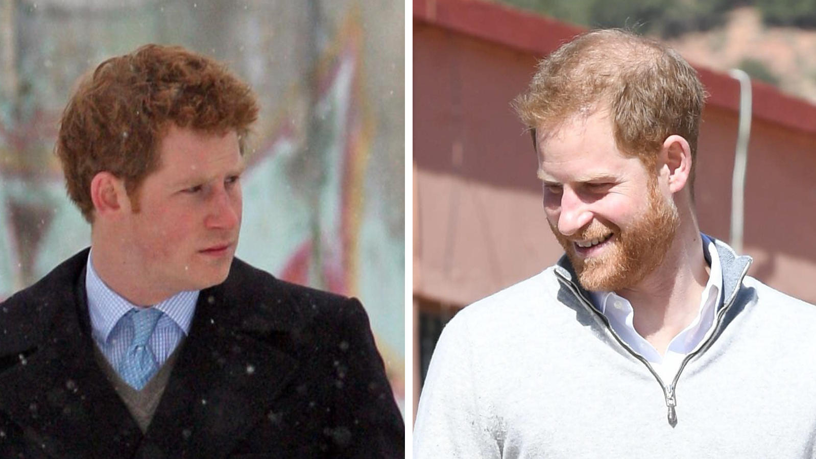 Von Prinz Harry zu Haarlos-Harry: DAS könnte sein Look mit 50 sein Prinz Harrys Frisur im Wandel der Zeit
