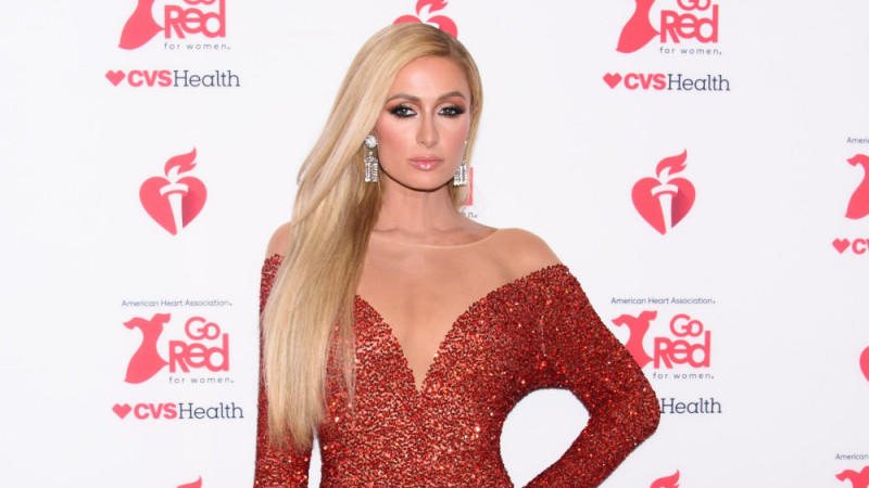 Paris Hilton: Kein Botox Paris Hilton: Kein Botox
