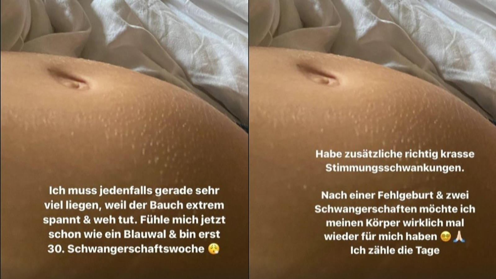 Schmerzen! Schwangere Marie Nasemann fühlt sich „wie ein Blauwal“ Schwangere Marie Nasemann fühlt sich "wie ein Blauwal" und leidet unter Schmerzen und Stimmungsschwankungen.