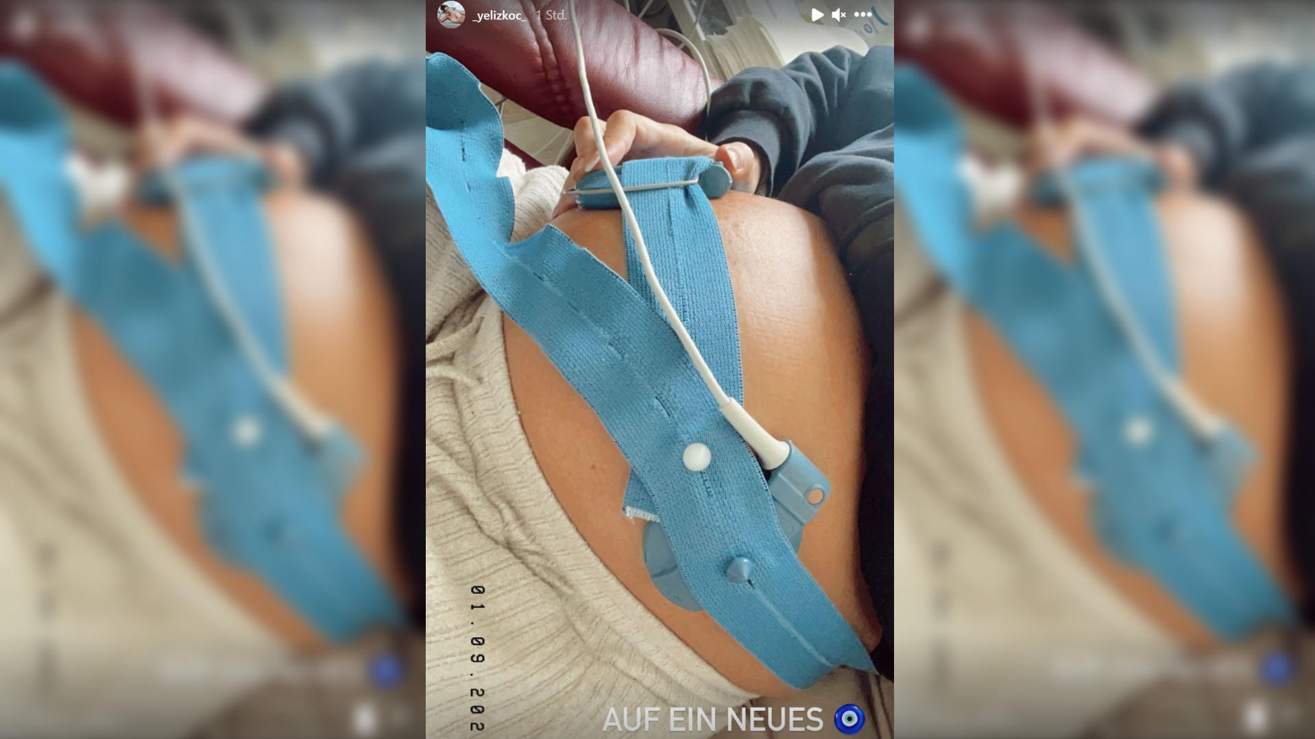 Yeliz Koc: Jetzt meldet sie sich zur Trennung von Jimi Blue Ochsenknecht Während Jimi das Liebes-Aus verkündet, lag Yeliz im Krankenhaus