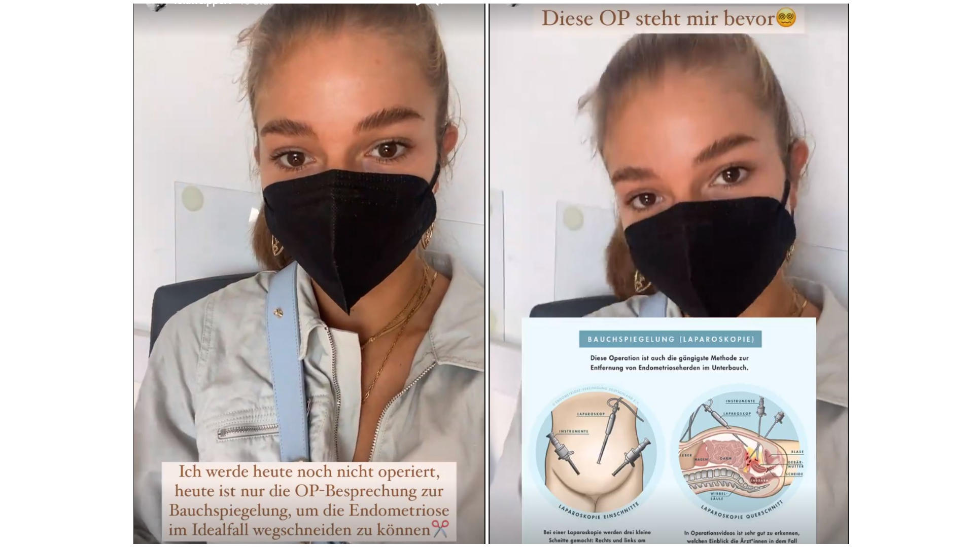 Lola Weippert: Ihre Hilfsmittel während der Periode Lola Weippert spricht offen über ihre Endometriose