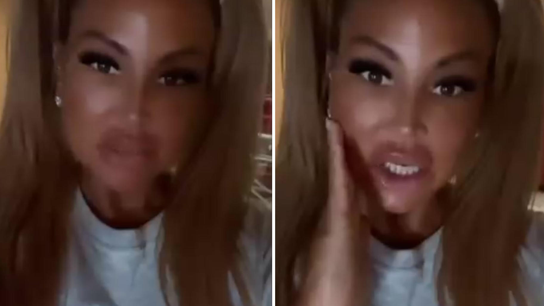 "Goodbye Deutschland"-Star Lisha hat sich doppelt unters Messer gelegt Lisha meldet sich mit geschwollenem Gesicht bei ihren Followern.