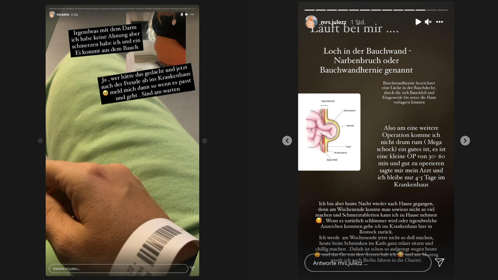 Trotz Krebsheilung: "Goodbye Deutschland"-Star Julia Holz wieder im Krankenhaus "Goodbye Deutschland"-Auswanderin Julia Holz hat eine Bauchwandhernie.