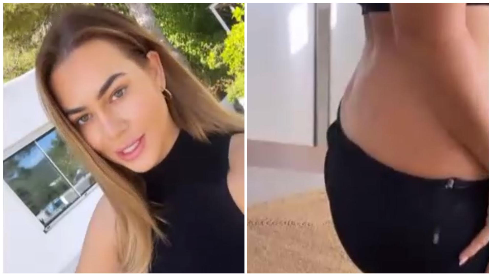 Jessica Paszka hat starke Schmerzen nach ihrem Sportunfall und zeigt "komische Beule" Jessica Paszka hat eine "komische Beule" am Rücken.