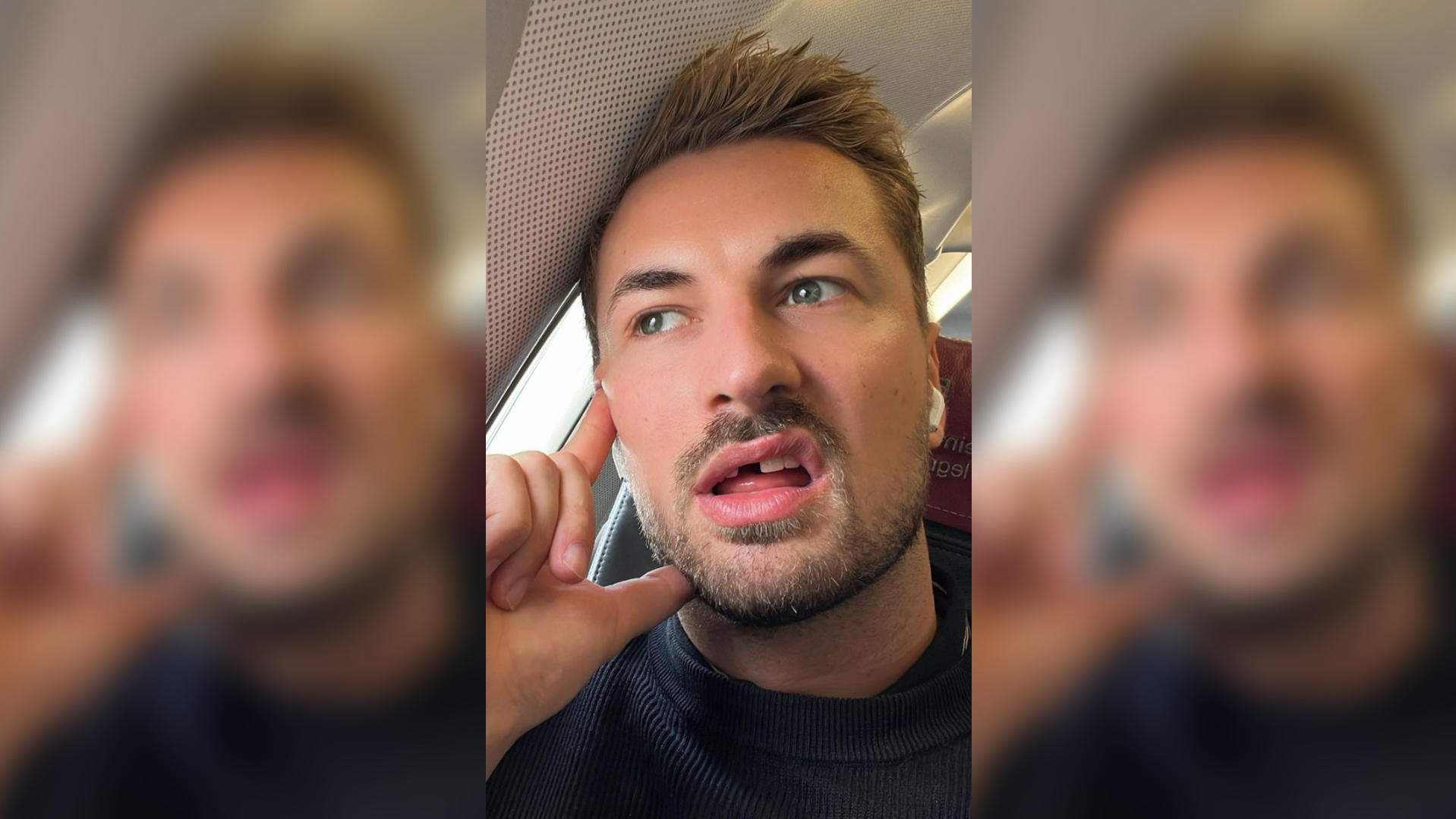 Ex-"Prince Charming" Nicolas Puschmann bricht Urlaub wegen Zahn-Notfall ab So hat sich Nicolas Puschmann seinen Urlaub ganz sicher nicht vorgestellt. Quelle: instagram/nicolaspuschmann