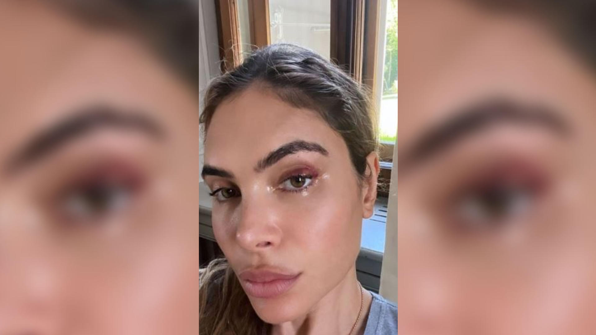 Autsch! Darum hat Robbie Williams' Frau Ayda Field ein blaues Auge Ayda Field zeigt sich auf Instagram mit blauem Auge - was ist passiert?