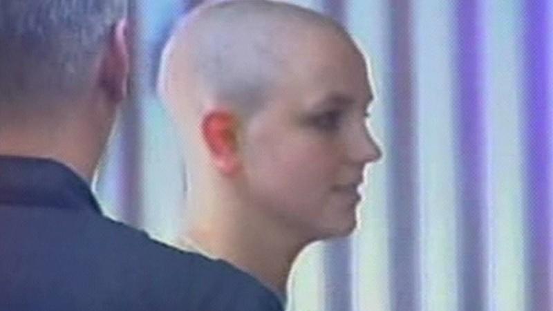 Britney Spears: Glatze, um einer Haarprobe zu entgehen? Britney Spears mit Glatze.