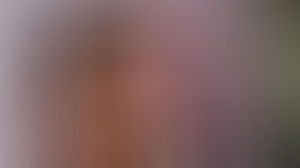 Vanessa Mai postet unbearbeitetes Bild: "Lasst euch nicht blenden" Vanessa Mai macht mit Pickeln Mut: "Lasst euch nicht blenden"