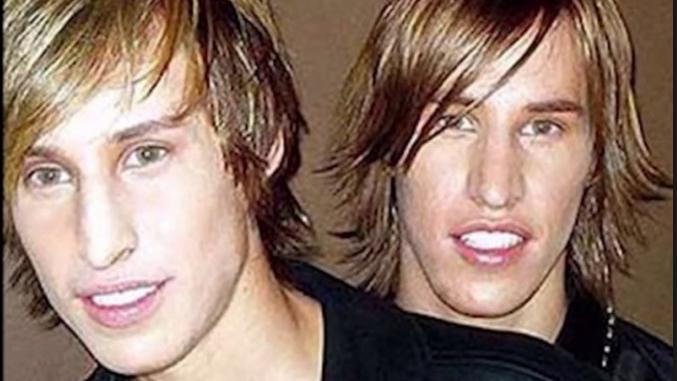 Aussehen wie Brad Pitt? Mike und Matt Schlepp haben schon 17.000 Euro in Beauty-OPs gesteckt Mike und Matt Schlepp wollten aussehen wie ihr Idol Brad Pitt.