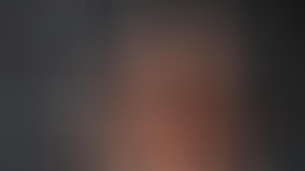 Kate Upton zeigt sich auch nach ihrem Shooting-Unfall gewohnt sexy Shooting-Malheur vergessen: Kate Upton legt sexy Auftritt hin