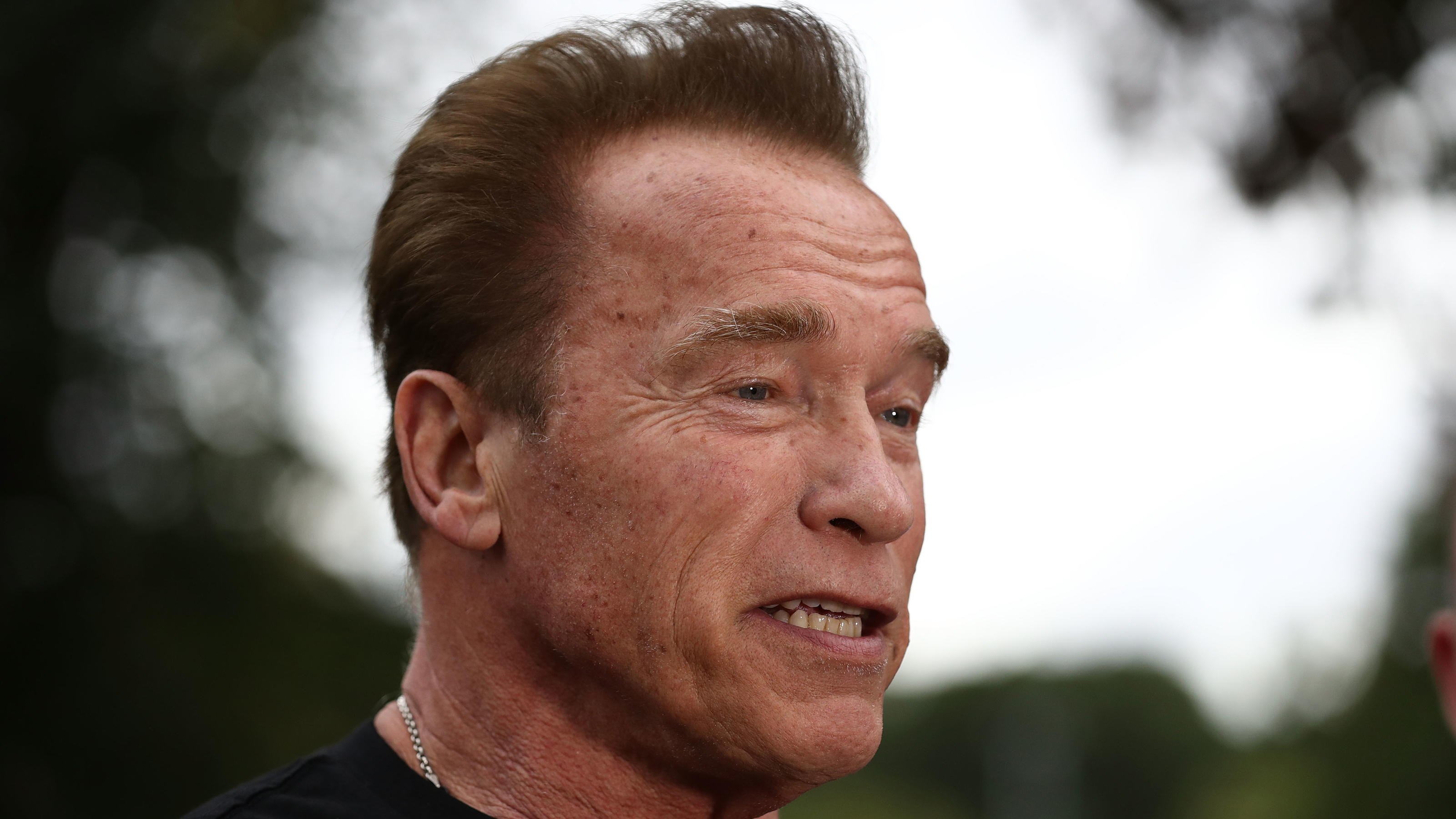 Arnold Schwarzenegger: So geht es ihm nach der Not-OP am Herzen Not-OP am Herzen: Arnold Schwarzenegger in Klinik