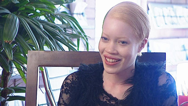 Diandra sticht auf dem Laufsteg heraus Albino-Model auf der Fashion Week