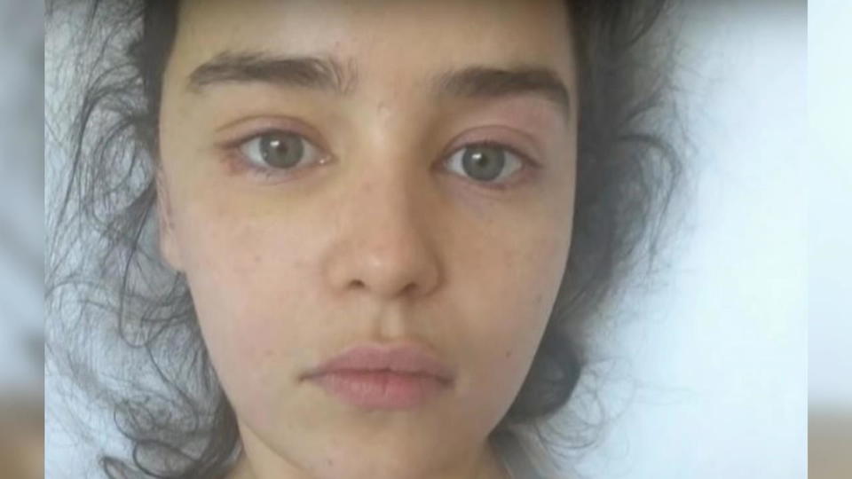 „Game of Thrones“-Star Emilia Clarke zeigt Bilder nach Hirn-OP