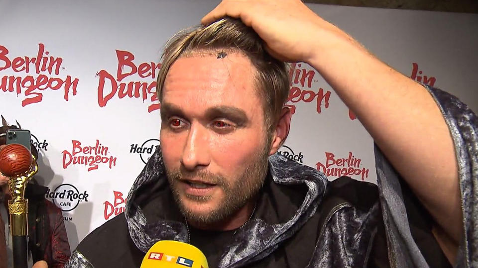 Haaransatz sitzt tiefer Nico Schwanz hat sich Haare transplantieren lassen