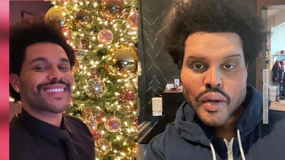 Was ist denn mit dem passiert? Sänger The Weeknd sieht plötzlich ganz verändert aus!