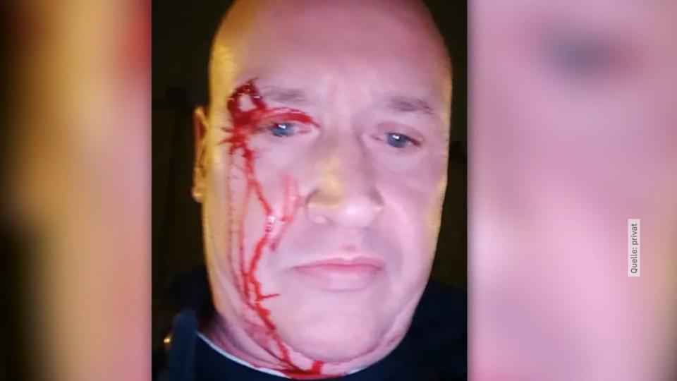 Mike Blümer verprügelt Rosenkrieg bei Melanie Müller wird blutig