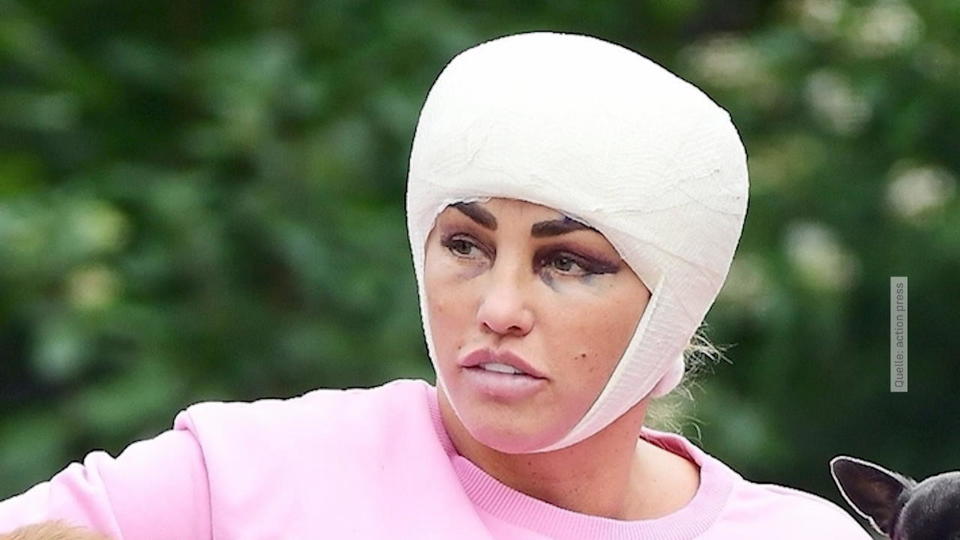 Blaue Augen & Kopfverband Katie Price war beim Beauty-Doc