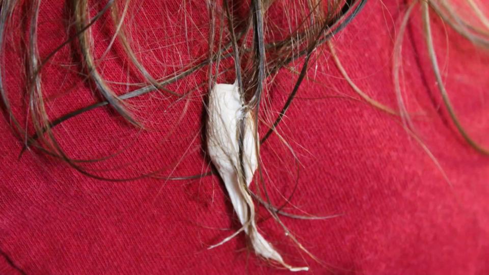 Nie mehr Kaugummi-Knoten! Dieser Trick entfernt in Sekunden Kaugummi aus den Haaren