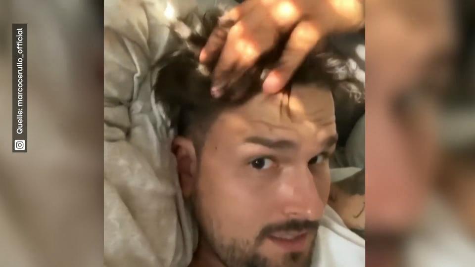 Volle Mähne Marco Cerullos Haar-Transplantation trägt Früchte!