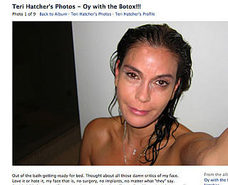 Teri Hatcher Botox Beweisfotos Facebook