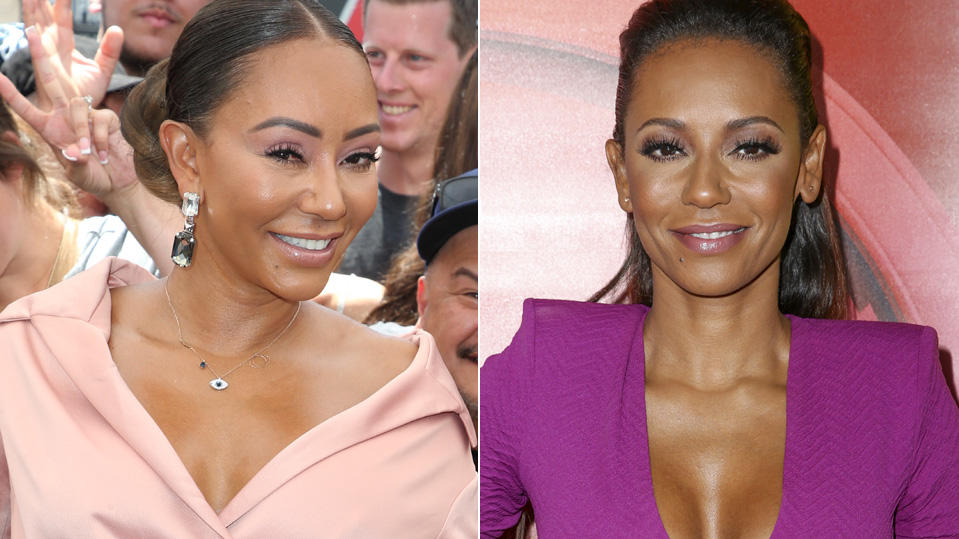 Nach Facelifting: Mel B Ist Kaum Wiederzuerkennen