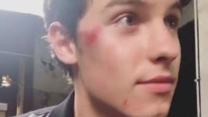 Shawn Mendes: Unfall!