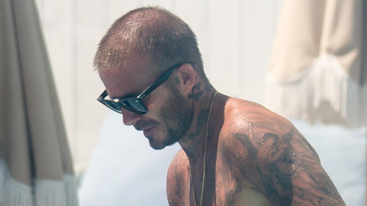 David Beckham Hatte Er Eine Haartransplantation