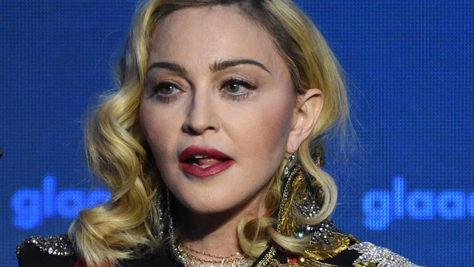Sängerin Madonna sieht auf aktuellen Fotos sehr verändert aus.