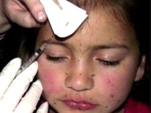 Hollywood Blog: Mutter spritzt Achtjähriger Botox