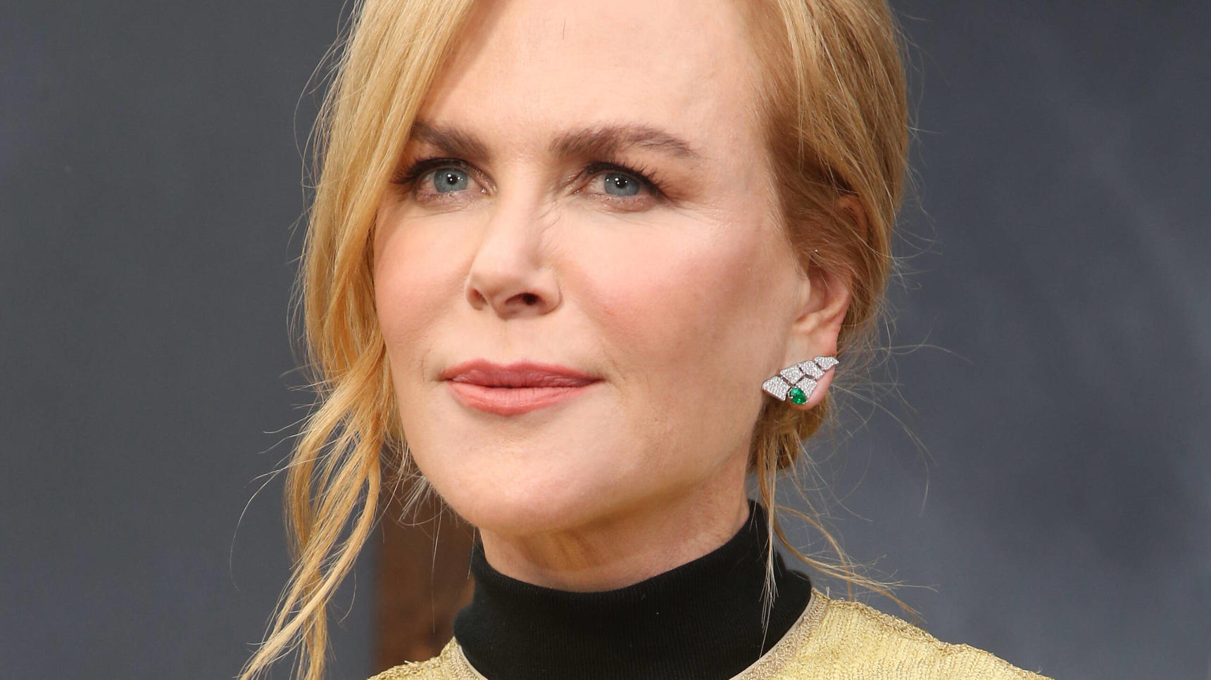 Follower unterstellen Nicole Kidman, dass sie Botox benutzt hat.