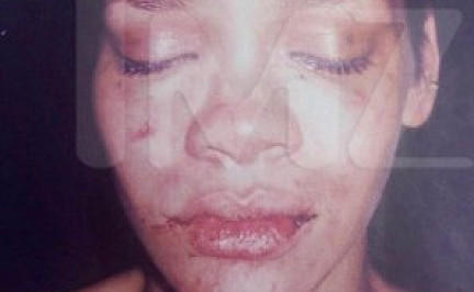 Alle Details zu Chris Browns Attacke auf Rihanna