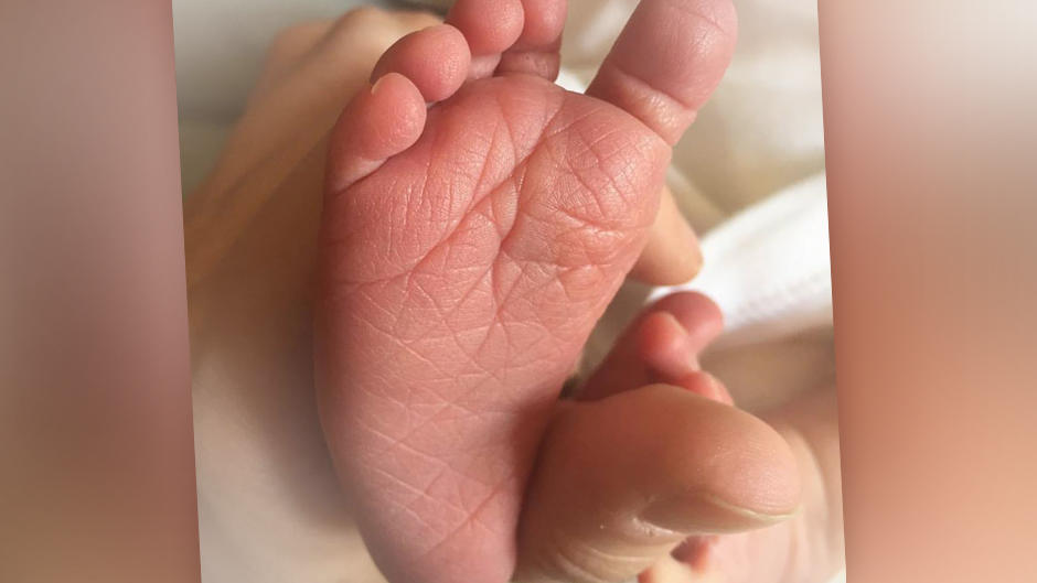 Tessa Bergmeier postet ein Foto von den Füßchen ihres Babys