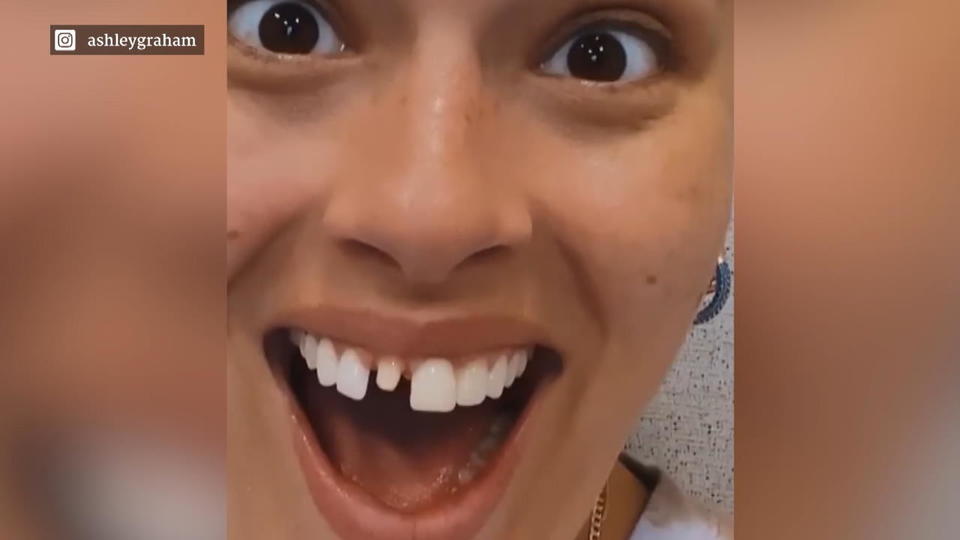 Ashley Graham hat sich einen Zahn abgebrochen