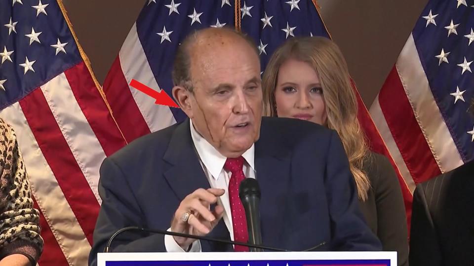 Rudy Giuliani & Co.: Peinliche Make-up-Pannen der Promis