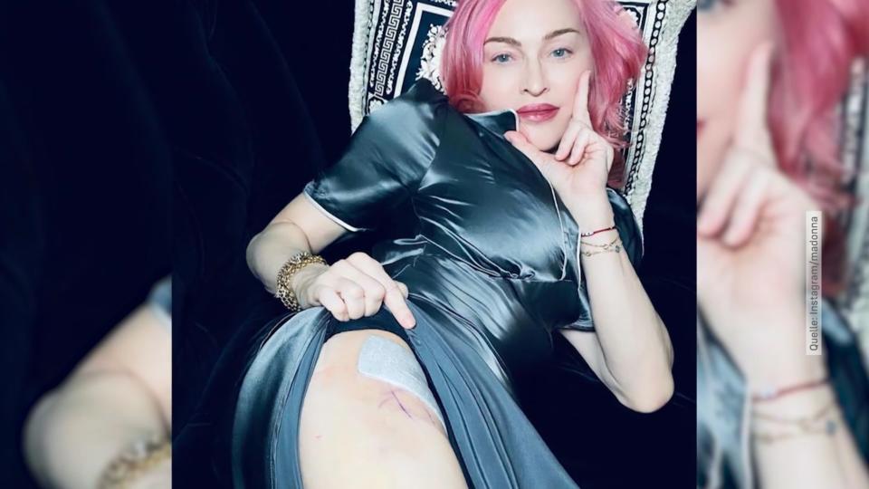 Madonna zeigt ihre Narbe an der Hüfte