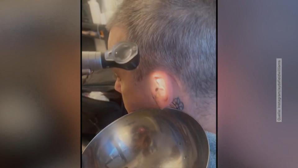 Iiihhh! Hier wird Robbie Williams' Ohr gereinigt