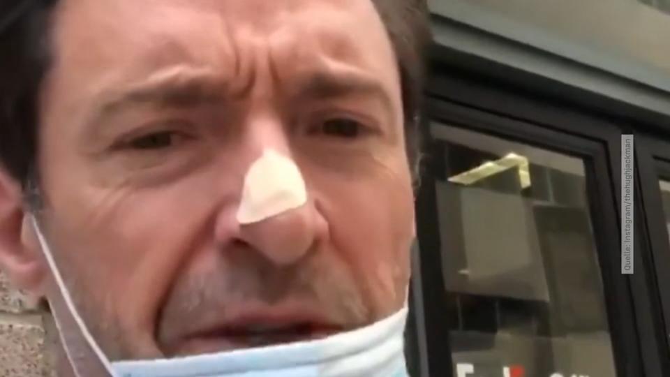 Hugh Jackman: Schon wieder Hautkrebs-Verdacht!