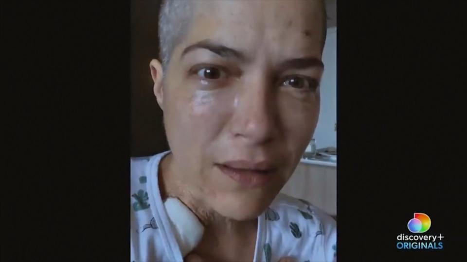 An MS erkrankte Selma Blair dreht Doku über ihren Leidensweg