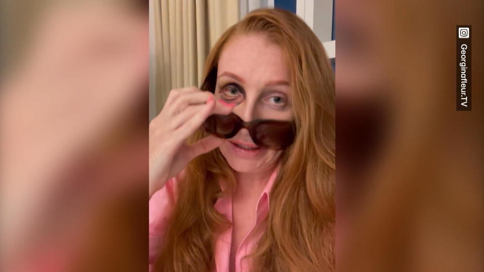 Unter Tränen zeigt Georgina Fleur ihr blaues Auge